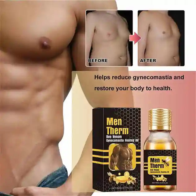 Men Therm Bee Venom Gynecomastia Heating Oil for Men – 30ml
