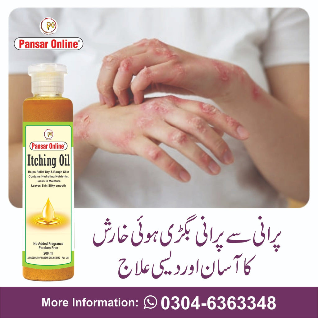 itching oil خارش چنبل اور سورائسز کے کے لئے مفید