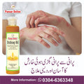itching oil خارش چنبل اور سورائسز کے کے لئے مفید