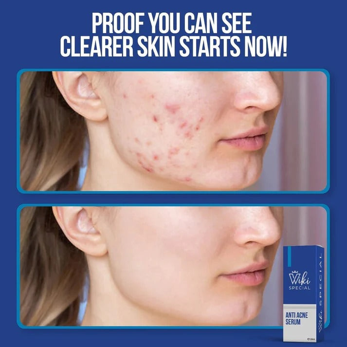 WIKI SPECIAL SERUM 30ML