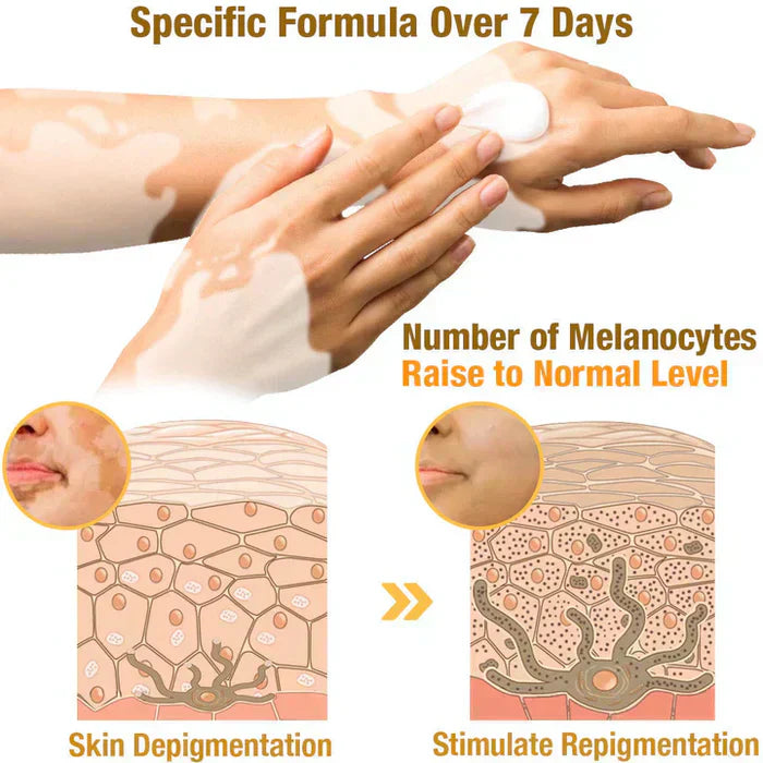 VitiGO™ Revitalizing Bee Venom Cream – Natural Skin Restoration & Vitality 🐝✨