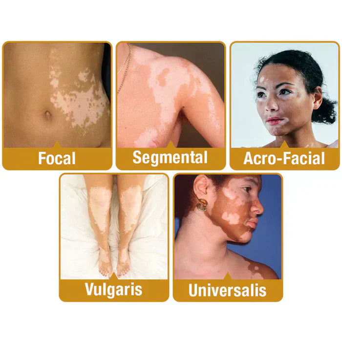 VitiGO™ Revitalizing Bee Venom Cream – Natural Skin Restoration & Vitality 🐝✨